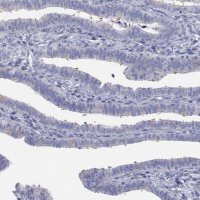 Anti-CDHR3 antibody produced in rabbit 