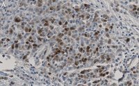 Anti-CDK1/CDC2 Antibody, clone 1J8 ZooMAb� Rabbit Monoclonal 