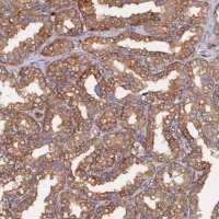 Anti-CDK18 antibody produced in rabbit HPA045429-100UL