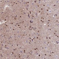 Anti-CDK18 antibody produced in rabbit HPA045429-100UL