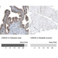 Anti-CDK20 antibody produced in rabbit