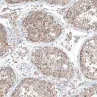 Anti-CDK20 antibody produced in rabbit