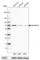 Anti-CDK5RAP3 antibody produced in rabbit