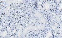 Anti-CDK6 Antibody, clone 2J3 ZooMAb� Rabbit Monoclonal 