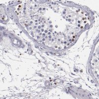 Anti-CDKL5 antibody produced in rabbit HPA002847-100UL