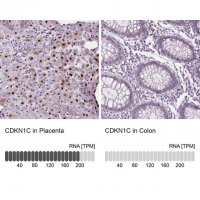 Anti-CDKN1C antibody produced in rabbit 