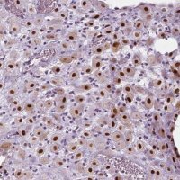Anti-CDKN1C antibody produced in rabbit 