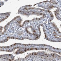 Anti-CDS1 antibody produced in rabbit
