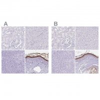 Anti-CDSN antibody produced in rabbit 