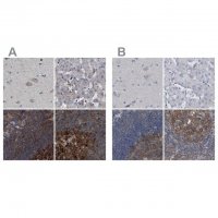 Anti-CDV3 antibody produced in rabbit 