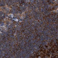 Anti-CDV3 antibody produced in rabbit 