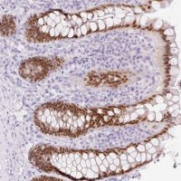 Anti-CDX1 antibody produced in rabbit 