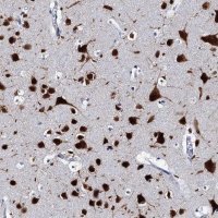 Anti-CELF2 antibody produced in rabbit 