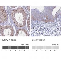 Anti-CENPV antibody produced in rabbit 