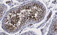 Anti-Centrin Antibody, clone 20H5 ZooMAb� Mouse Monoclonal 