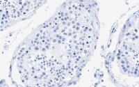 Anti-Centrin Antibody, clone 20H5 ZooMAb� Mouse Monoclonal 