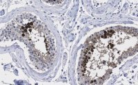 Anti-Centrin-1 Antibody, clone 5L17 ZooMAb� Rabbit Monoclonal 
