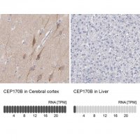 Anti-CEP170B antibody produced in rabbit