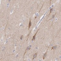 Anti-CEP170B antibody produced in rabbit