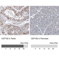 Anti-CEP192 antibody produced in rabbit 