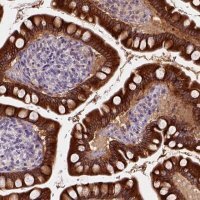 Anti-CES2 antibody produced in rabbit 