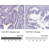 Anti-CFAP100 antibody produced in rabbit 