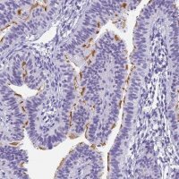 Anti-CFAP100 antibody produced in rabbit 