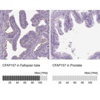 Anti-CFAP157 antibody produced in rabbit 