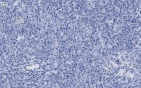 Anti-CFTR Antibody, clone 1C22 ZooMAb® Rabbit Monoclonal