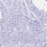 Anti-CGB3 antibody produced in rabbit 
