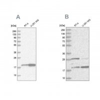 Anti-CGGBP1 antibody produced in rabbit