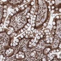 Anti-CGGBP1 antibody produced in rabbit