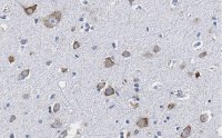 Anti-CGRP-1 Antibody, clone 2E18 ZooMAb� Rabbit Monoclonal 