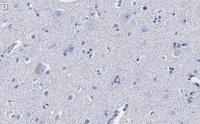 Anti-CGRP-1 Antibody, clone 2E18 ZooMAb� Rabbit Monoclonal 