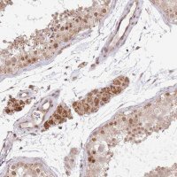 Anti-CHD1 antibody produced in rabbit