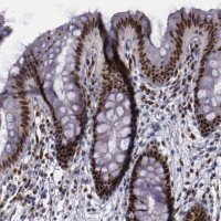 Anti-CHEK2 antibody produced in rabbit 