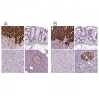 Anti-CHGB antibody produced in rabbit 