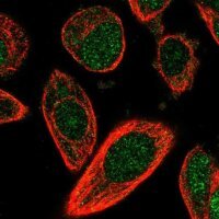 Anti-CHML antibody produced in rabbit HPA029627-100UL