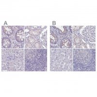 Anti-CHMP5 antibody produced in rabbit 