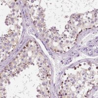Anti-CHODL antibody produced in rabbit