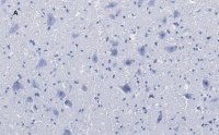 Anti-Choline Acetyltransferase (ChAT) Antibody, clone 2K16, ZooMAb� Rabbit Monoclonal 