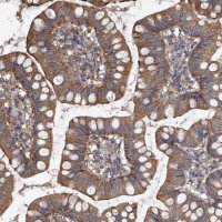 Anti-CHPF antibody produced in rabbit 
