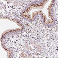 Anti-CHST4 antibody produced in rabbit