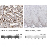 Anti-CIART antibody produced in rabbit HPA027515-100UL