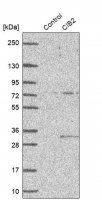 Anti-CIB2 antibody produced in rabbit 