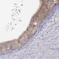 Anti-CITED1 antibody produced in rabbit