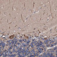 Anti-CKAP5 antibody produced in rabbit 
