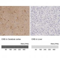 Anti-CKB antibody produced in rabbit 