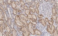 Anti-Claudin 6 Antibody, clone 1B22 ZooMAb� Rabbit Monoclonal 