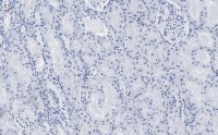 Anti-Claudin 6 Antibody, clone 1B22 ZooMAb� Rabbit Monoclonal 